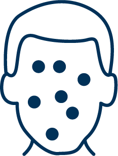Icon representing Measles, Mumps, Rubella (MMR)