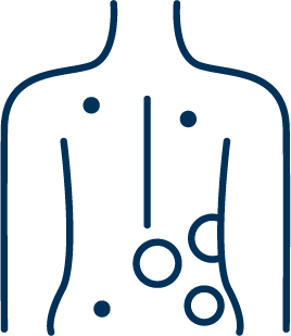 Icon representing Herpes Zoster